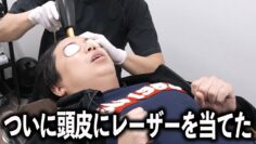 断り続けてきた薄毛の案件ついに解禁