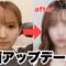 【美容施術初公開】小顔になりすぎました🥺【1day小顔脂肪吸引】