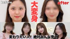 【視聴者整形企画】変わりたい人、悩みがある人必見です‼️‼️