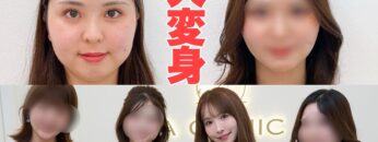 【視聴者整形企画】変わりたい人、悩みがある人必見です‼️‼️