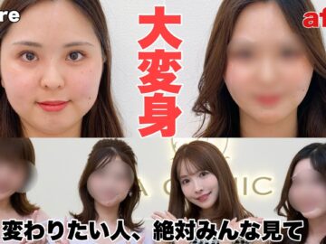 【視聴者整形企画】変わりたい人、悩みがある人必見です‼️‼️