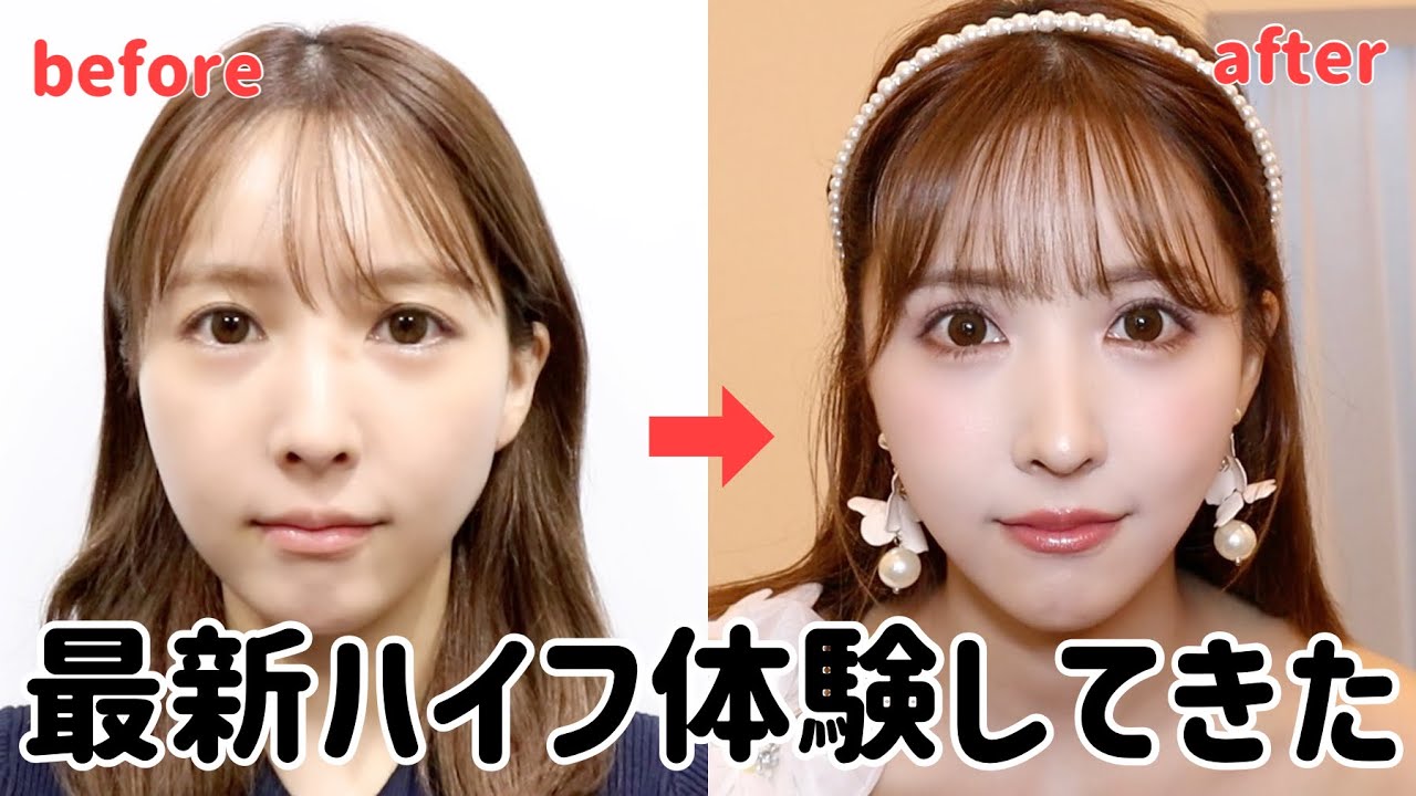 プリロード画像