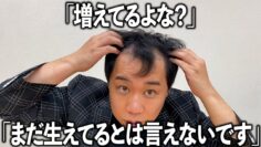 レーザー治療で増えた髪の毛をみんなに見てもらう